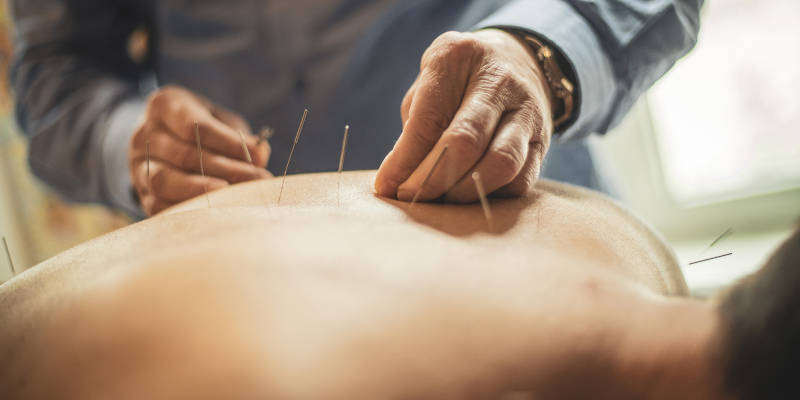 How Acupuncture Cures Muscle Pain