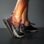 Sports Injuries in Pickering, Ontario