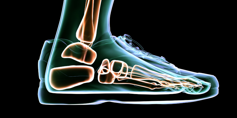 How Can Custom Orthotics Help Your Feet? 
